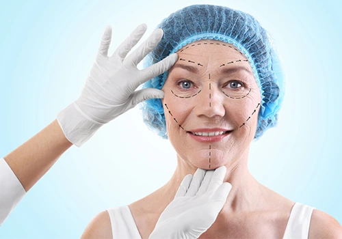 Facelift Surgery