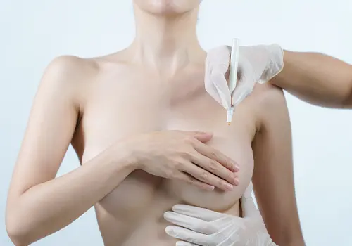 every thing about Breast Lift