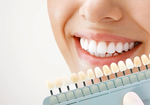 Reasons for Teeth Discoloration