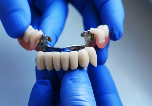 Dental Bridges Risks and Considerations