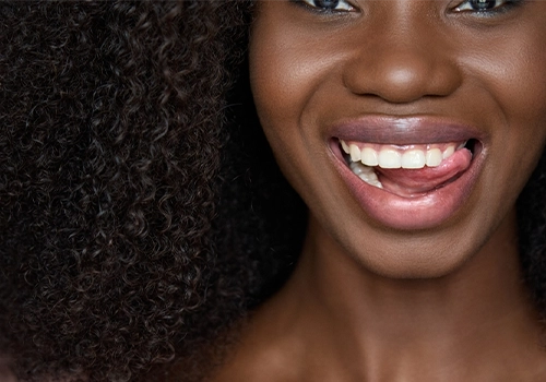 The Cost of Hollywood Smile Dentistry 